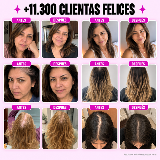 BLUME™  Suplemento anticaída diario para mujeres
