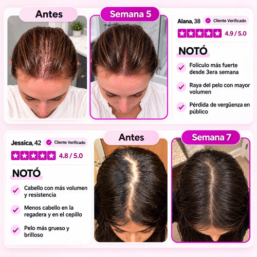 BLUME™  Suplemento anticaída diario para mujeres